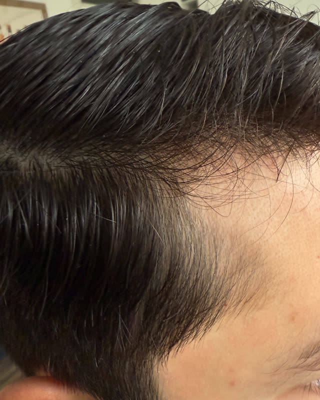 After