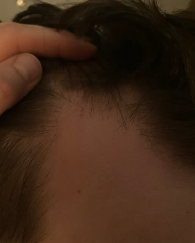 Before