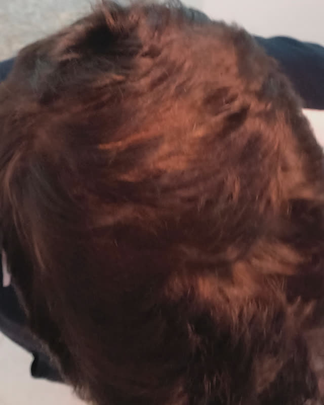 Before