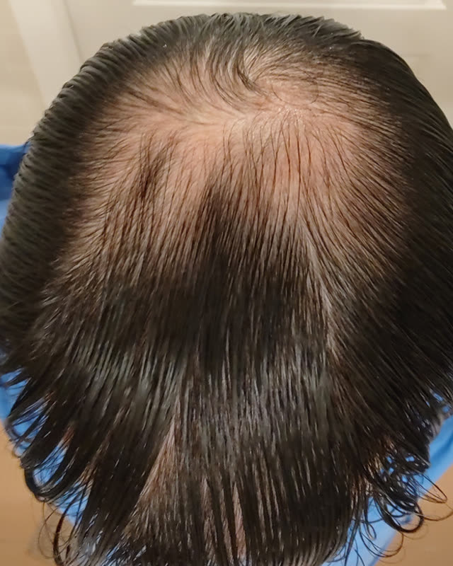 After