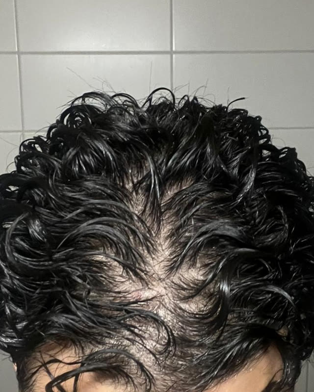 After