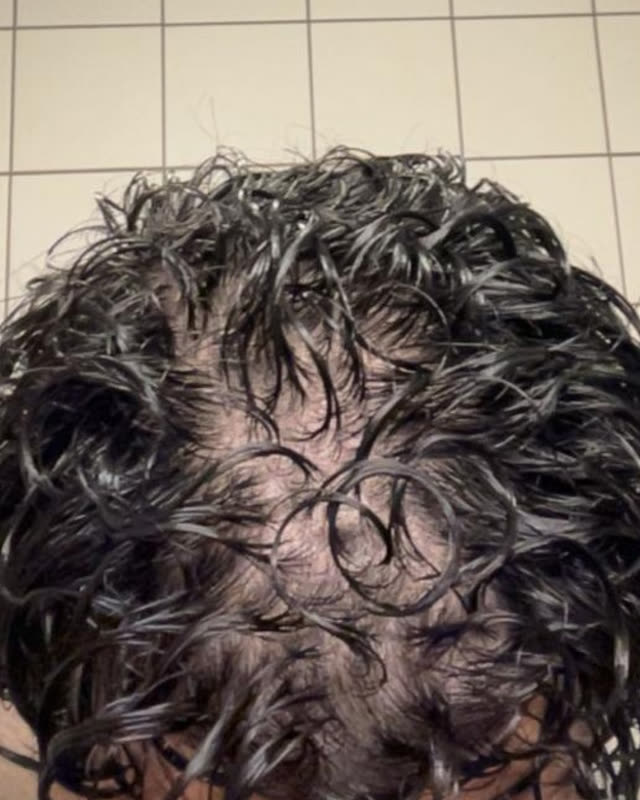 Before