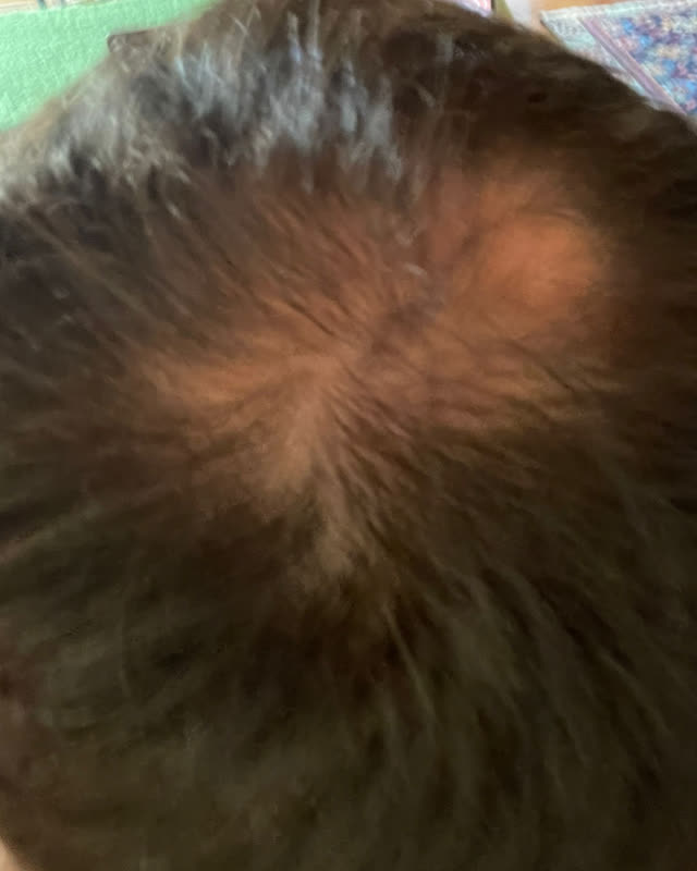 Before