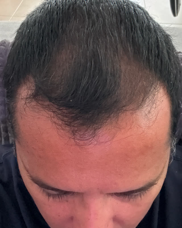 After