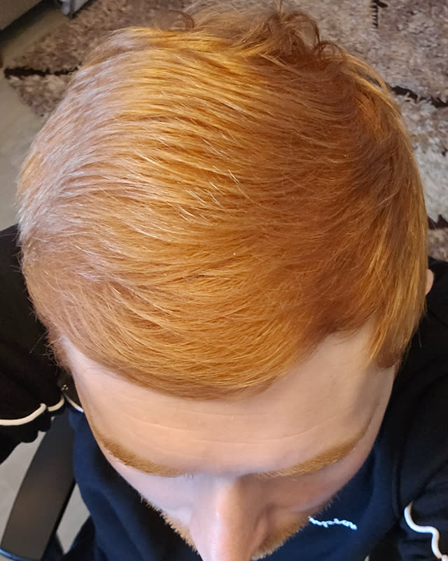 After
