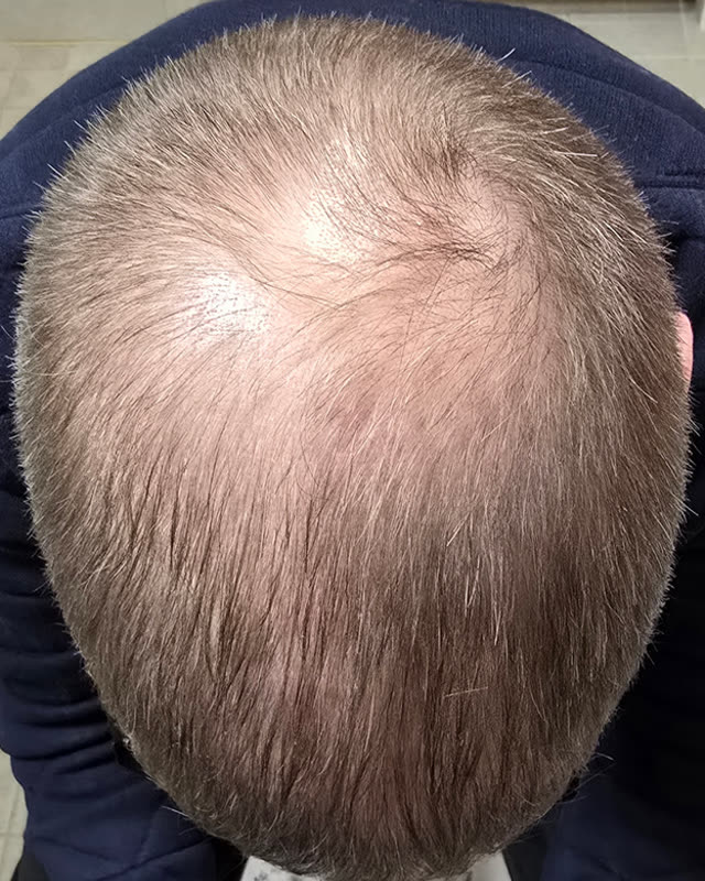 Before