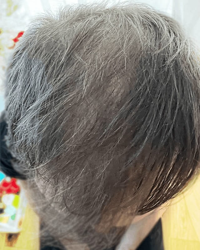 After