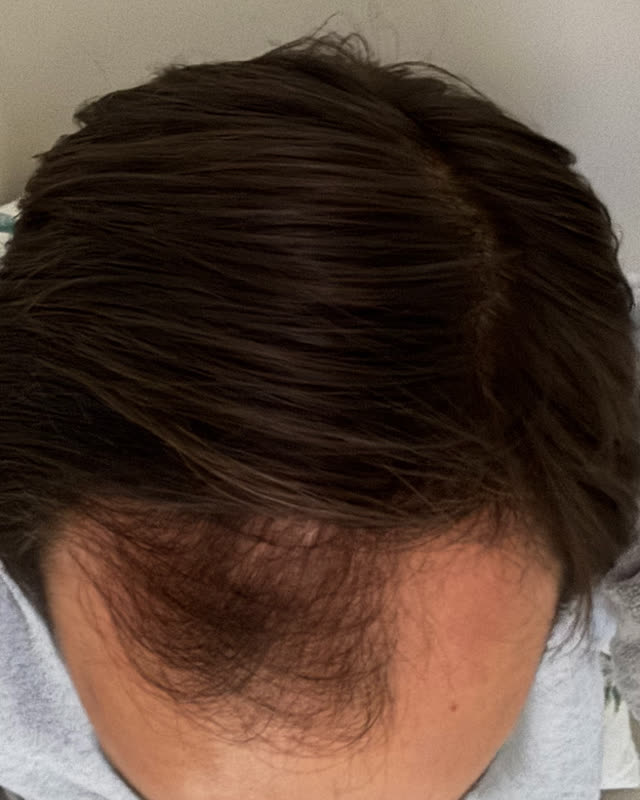 After