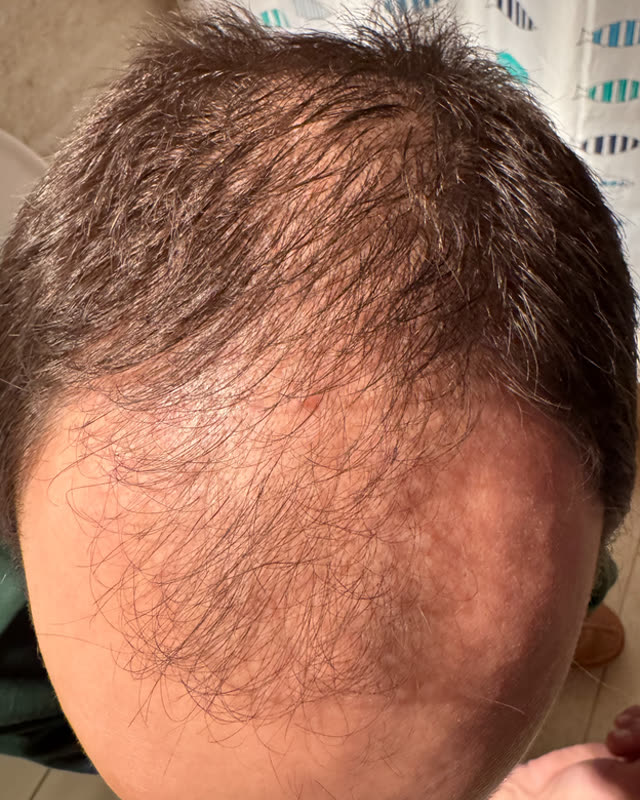 Before