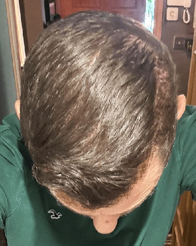 After