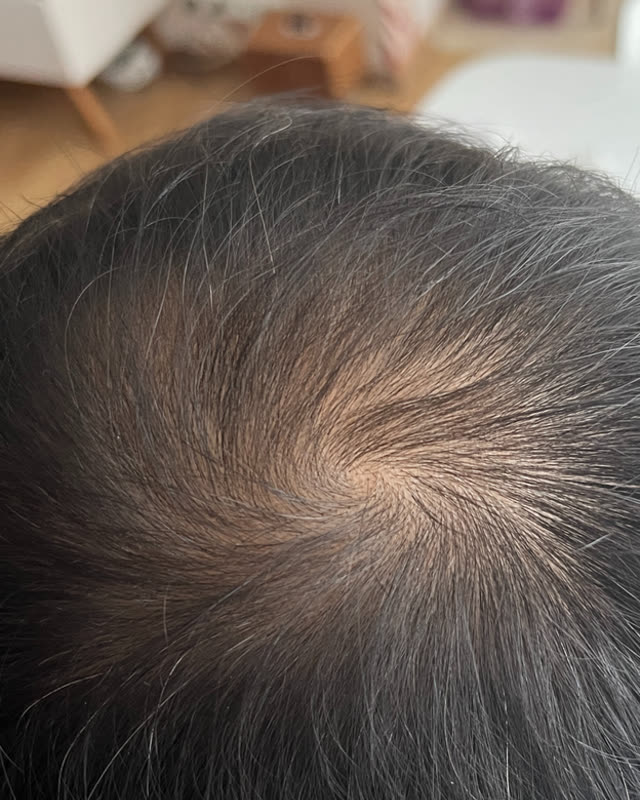 Before