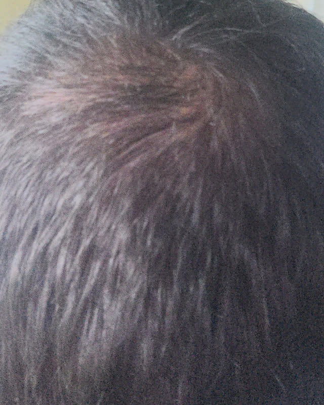 After