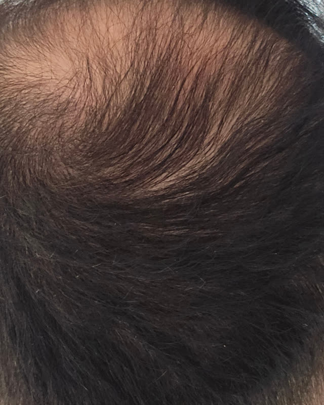 Before