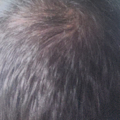 After